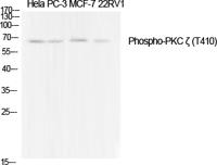 PKC ζ (phospho Thr410) Polyclonal Antibody