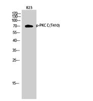 PKC ζ (phospho Thr410) Polyclonal Antibody