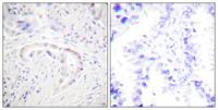 PKC ζ (phospho Thr410) Polyclonal Antibody