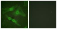 PKC ζ (phospho Thr410) Polyclonal Antibody