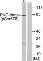 PKC θ (phospho Ser676) Polyclonal Antibody