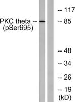 PKC θ (phospho Ser695) Polyclonal Antibody