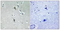 PKC θ (phospho Thr538) Polyclonal Antibody