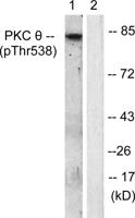 PKC θ (phospho Thr538) Polyclonal Antibody