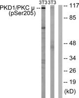 PKD1 (phospho Ser205) Polyclonal Antibody