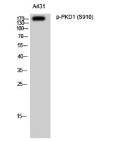 PKD1 (phospho Ser910) Polyclonal Antibody