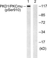 PKD1 (phospho Ser910) Polyclonal Antibody