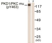 PKD1 (phospho Tyr463) Polyclonal Antibody