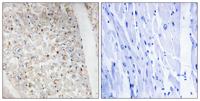 PKD1/2/3 (phospho Ser738/S742) Polyclonal Antibody