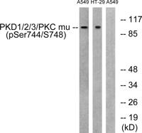 PKD1/2/3 (phospho Ser738/S742) Polyclonal Antibody