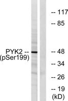 PYK2 (phospho Tyr402) Polyclonal Antibody