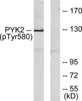 PYK2 (phospho Tyr580) Polyclonal Antibody