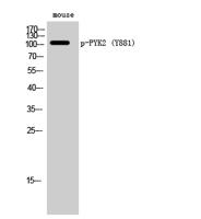 PYK2 (phospho Tyr881) Polyclonal Antibody