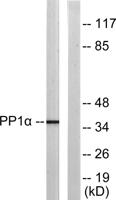 PP1α (phospho Thr320) Polyclonal Antibody