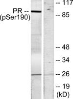 PR (phospho Ser190) Polyclonal Antibody