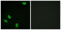 PR (phospho Ser294) Polyclonal Antibody