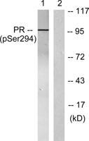 PR (phospho Ser294) Polyclonal Antibody