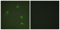 PR (phospho Ser400) Polyclonal Antibody