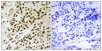 PRAK (phospho Thr182) Polyclonal Antibody