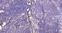 PRC1(Phospho Thr481)Polyclonal Antibody