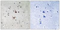 Presenilin 1 (phospho Ser357) Polyclonal Antibody