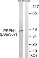 Presenilin 1 (phospho Ser357) Polyclonal Antibody