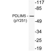 PDLIM5 (phospho Tyr251) Polyclonal Antibody