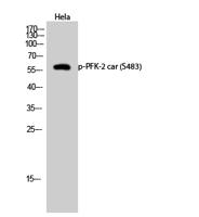 PFK-2 car (phospho Ser483) Polyclonal Antibody