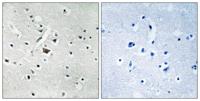 PC-PLD2 (phospho Tyr169) Polyclonal Antibody