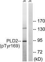 PC-PLD2 (phospho Tyr169) Polyclonal Antibody