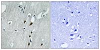 Pdcd-4 (phospho Ser457) Polyclonal Antibody