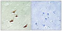 Pdcd-4 (phospho Ser67) Polyclonal Antibody