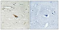 Pdcd-4 (phospho Ser67) Polyclonal Antibody