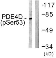 PDE4B/C/D (phospho Ser133/119/190) Polyclonal Antibody