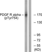 PDGFR-α (phospho Tyr754) Polyclonal Antibody