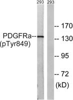 PDGFR-α (phospho Tyr849) Polyclonal Antibody