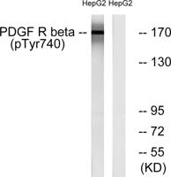 PDGFR-β (phospho Tyr740) Polyclonal Antibody