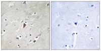 PDPK1 (phospho Tyr9) Polyclonal Antibody