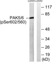 PAK5/6 (phospho Ser602/S560) Polyclonal Antibody