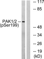 PAKα (phospho Ser199) Polyclonal Antibody