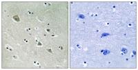 PAKα (phospho Ser204) Polyclonal Antibody