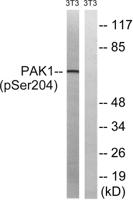 PAKα (phospho Ser204) Polyclonal Antibody