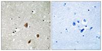 PAKβ (phospho Ser154) Polyclonal Antibody