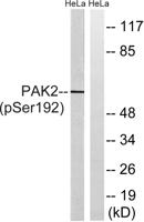 PAKγ (phospho Ser192) Polyclonal Antibody