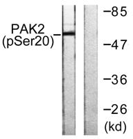 PAKγ (phospho Ser20) Polyclonal Antibody