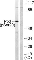 p53 (phospho Ser20) Polyclonal Antibody