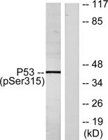 p53 (phospho Ser315) Polyclonal Antibody