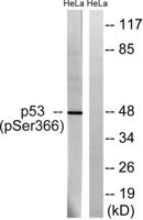 p53 (phospho Ser366) Polyclonal Antibody