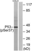 p53 (phospho Ser37) Polyclonal Antibody