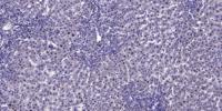 p53 (phospho Ser37) Polyclonal Antibody